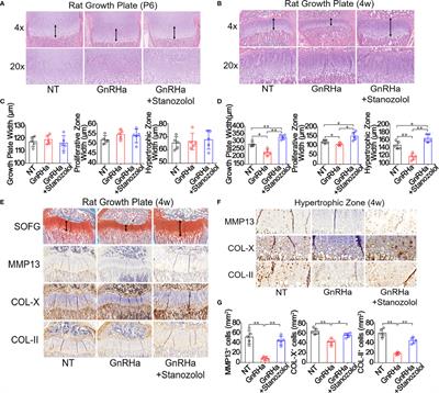 GnRHa/Stanozolol Combined Therapy Maintains Normal Bone Growth in Central Precocious Puberty